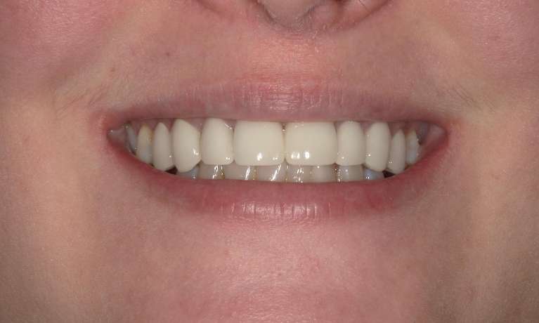 patient smiling